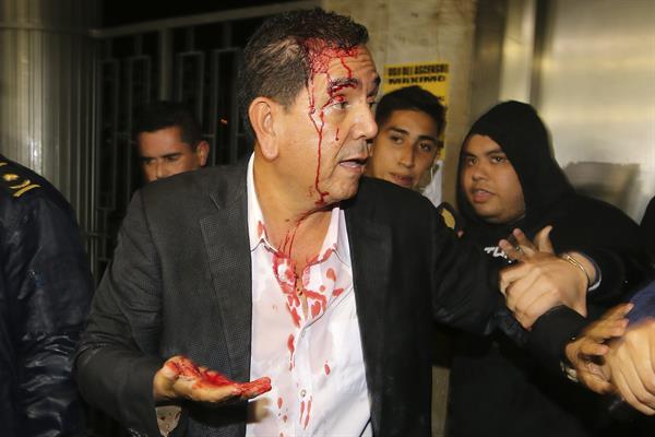 El diputado por el Partido Nacional Antonio Rivera es resguardado después de ser agredido por simpatizantes del gobernante Partido Libertad y Refundación (Libre), en el Congreso Nacional en Tegucigalpa .