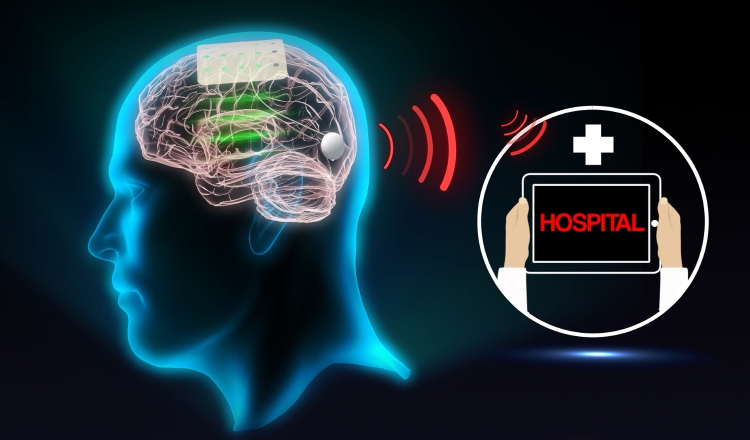 Infografía de cómo funciona un sensor interfaz cerebro-máquina. Fotos: EFE