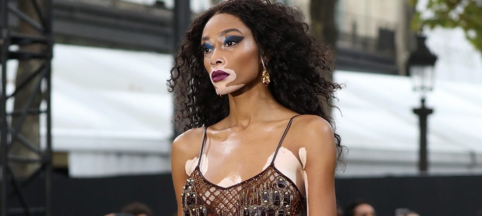 Winnie Harlow.